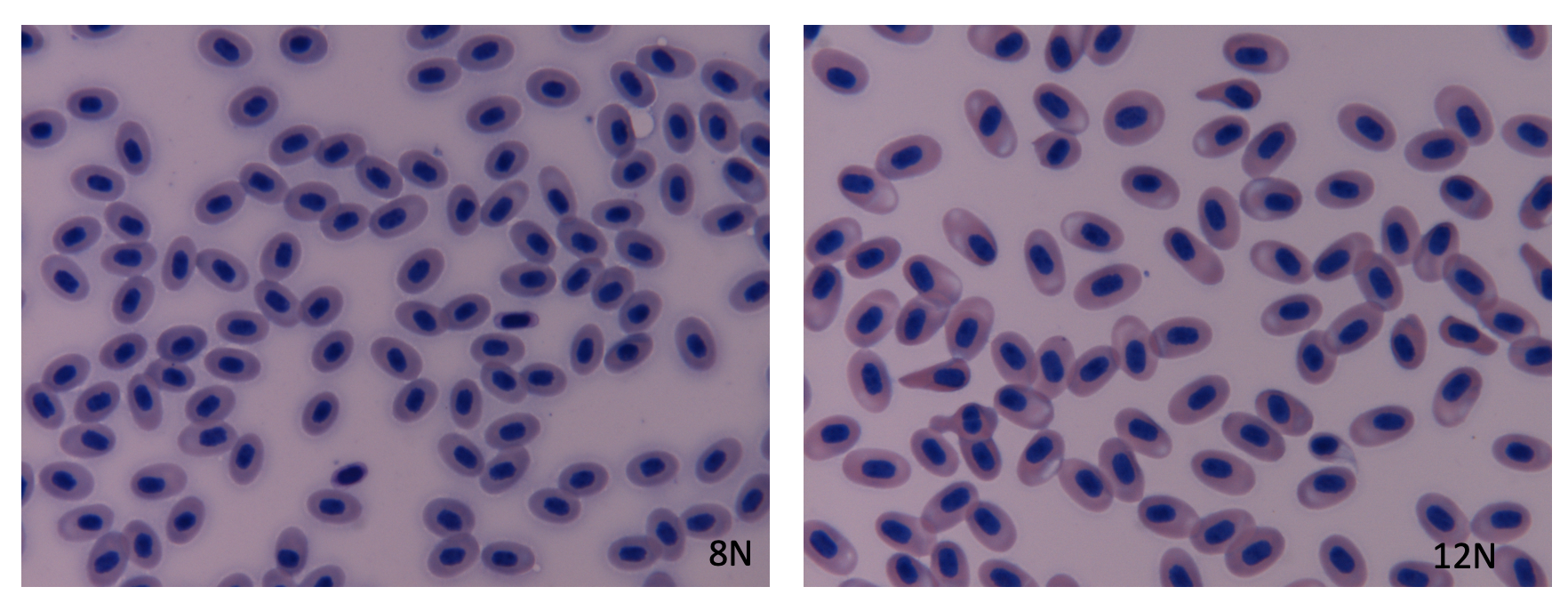 8N and 12N blood smears